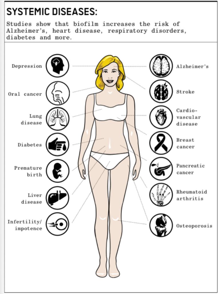 Guided Biofilm Therapy bodily health through oral microbiome